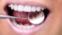 ارتودنسی دندان | کلینیک دندانپزشکی تاج 3