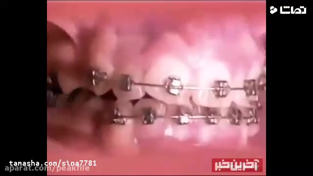 ارتودنسی دندان | کلینیک دندانپزشکی تاج 2