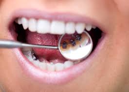 ارتودنسی دندان | کلینیک دندانپزشکی تاج 3